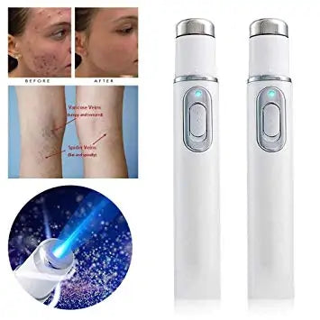 Anti-acne light pen